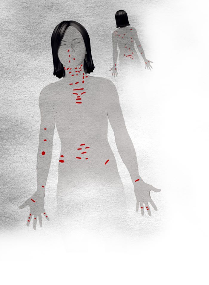 Skiss över Marias kropp sedd framifrån och bakifrån med knuivhuggen markerade i rött. Illustration.